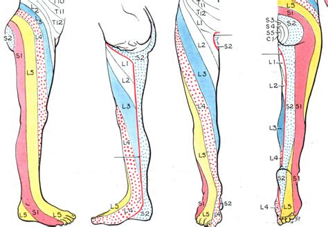 s1 symptoms nerve impingement